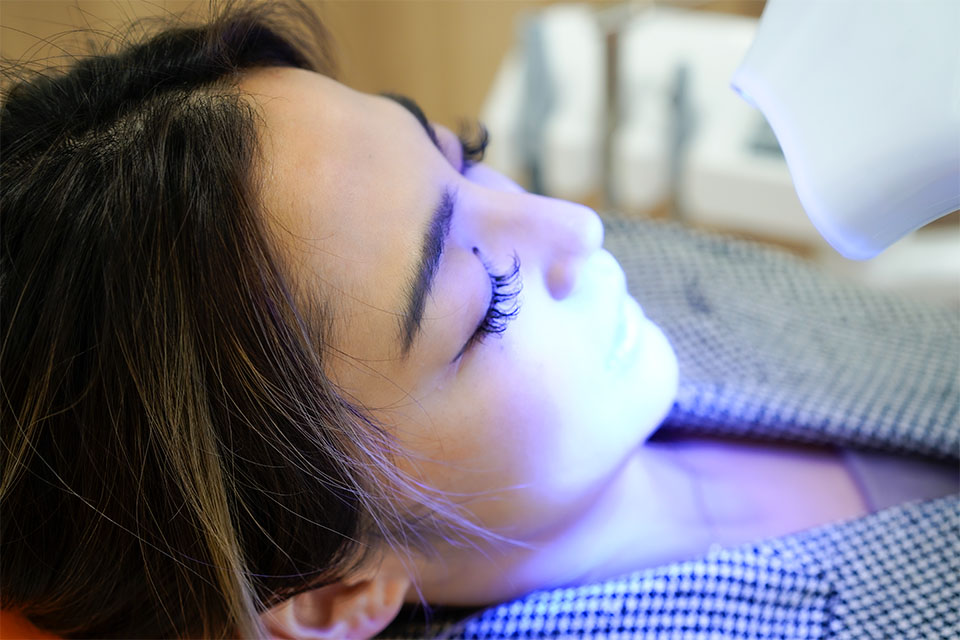 歯のホワイトニング AERU歯科&矯正歯科 浜田山