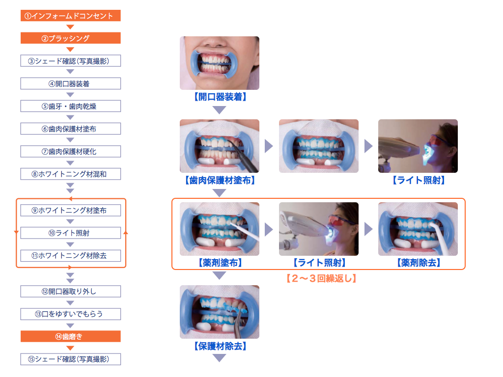 浜田山で歯のホワイトニング　AERU歯科＆矯正歯科