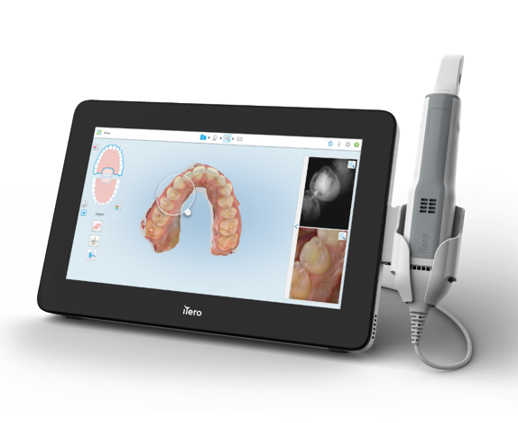 iTero|AERU歯科&矯正歯科