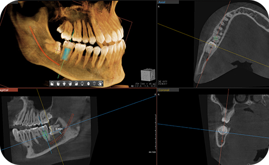 CTレントゲン｜AERU歯科&矯正歯科