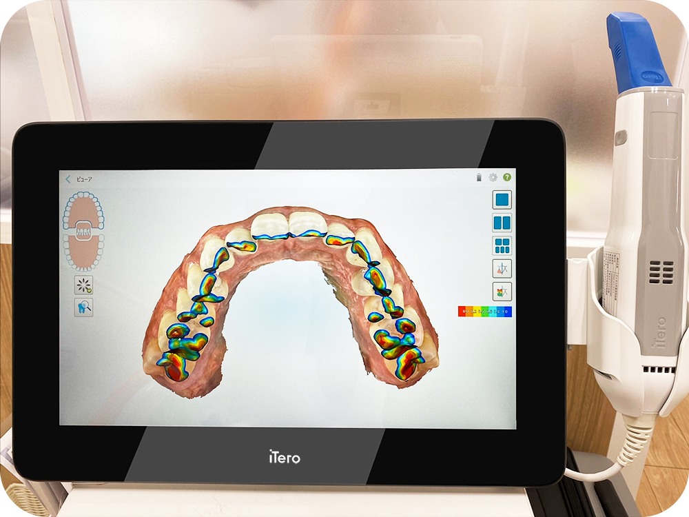 ITERO｜AERU歯科&矯正歯科