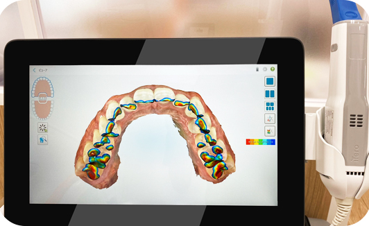 itero｜AERU歯科&矯正歯科