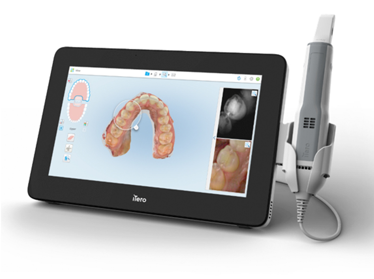 itero｜AERU歯科&矯正歯科